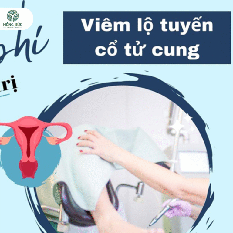 Những chi phí điều trị Viêm Lộ Tuyến Cổ Tử  Cung