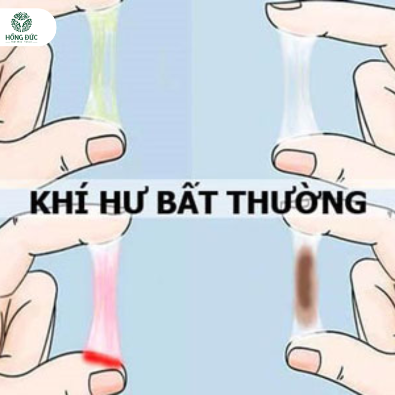 Điều trị viêm lộ tuyến: Giải pháp hiệu quả & an toàn cho phụ nữ hiện đại 3 Ưu điểm: Điều trị không xâm lấn, không đau, an toàn, hiệu quả lâu dài.